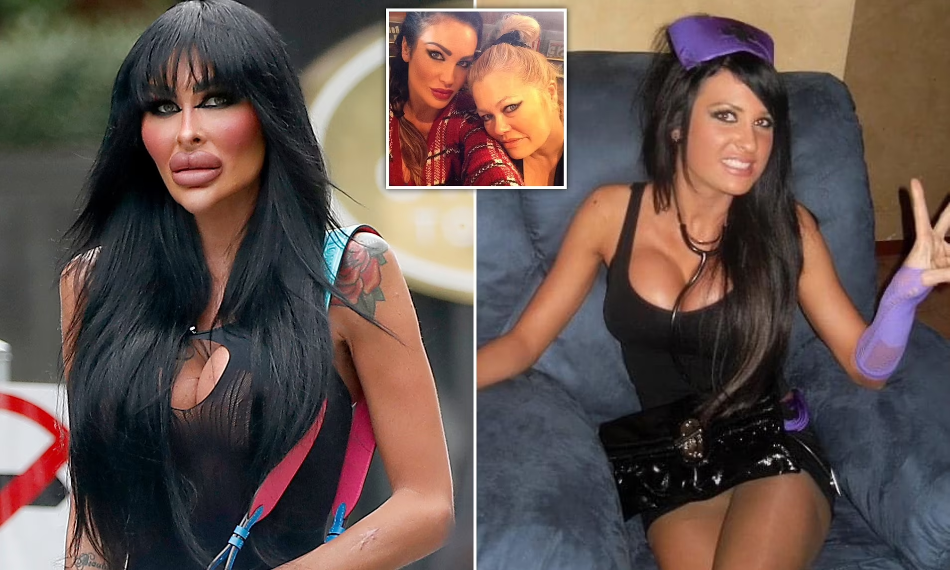 Plastic surgery addict spends $200K on plastic surgery