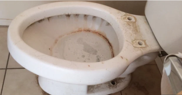 Expert reveals cause of tough toilet stains and their removal