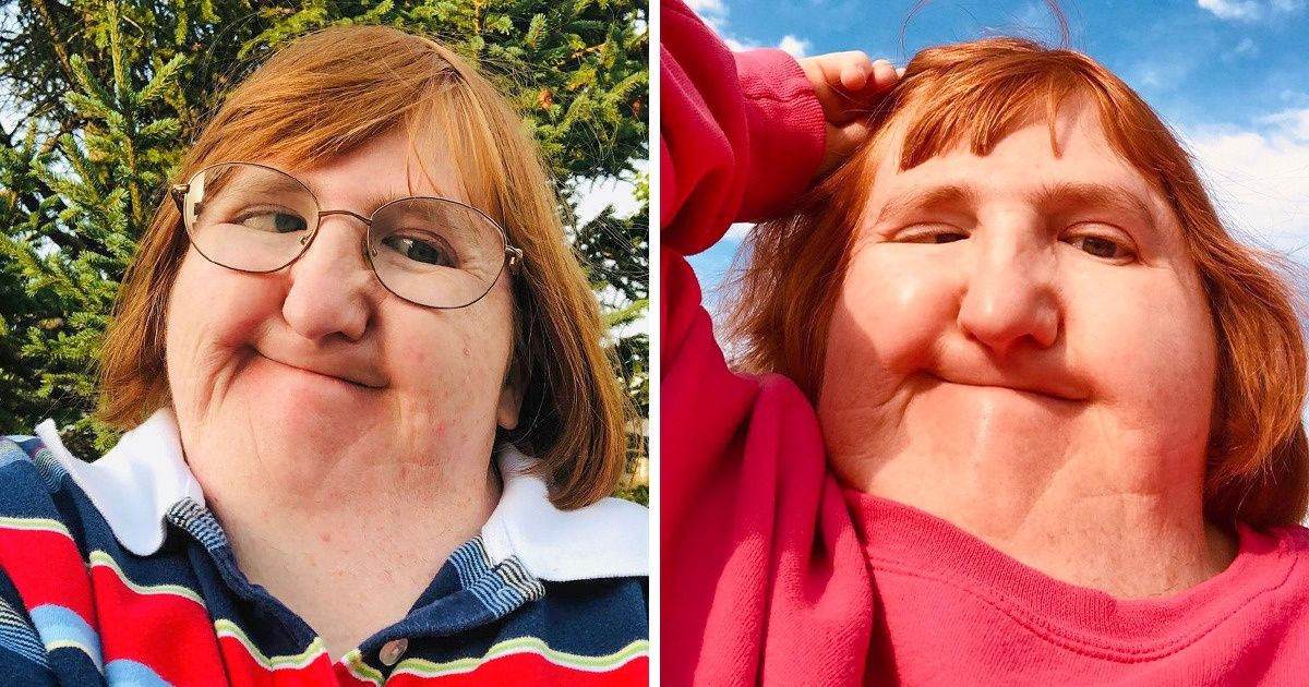 Bullied woman ‘too ugly’ for selfies takes one a day for a year