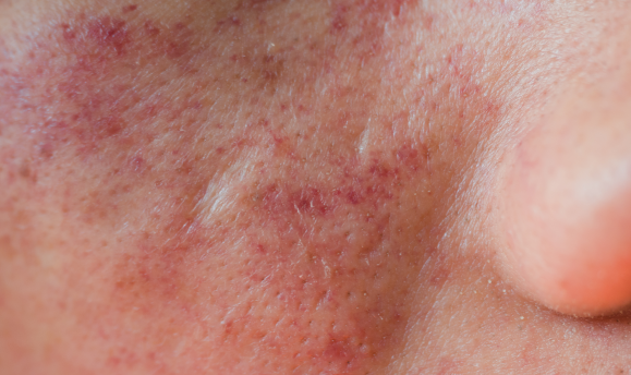 Warning signs you should never ignore on your skin